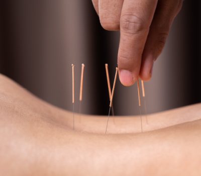 acupuncture program main 3